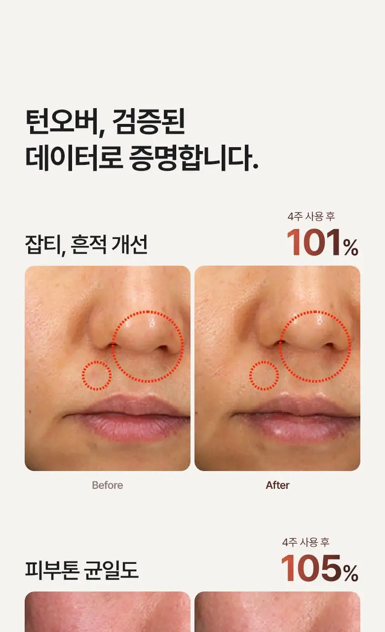 [피부결/흔적개선] 메디테라피 레티날 스킨 부스터 세럼 150ml 상세페이지 21
